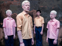 BlindAlbinism_06.jpg