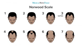 the-norwood-scale.jpg