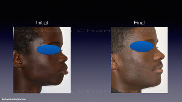 harmonie-faciale6.jpg