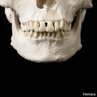 Skull Skull