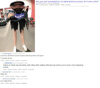 leg lenghtening.jpg