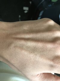 Hand