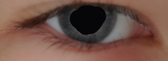 Eye.png