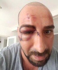 0x0-turkish-man-severely-beaten-by-far-right-group-in-belgium-1496047451874.jpg