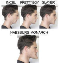 habsburg_jaw.png