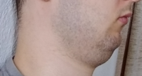 over.png