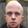 baldfartsniffer