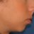 ProfileViewCel